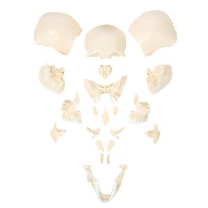 Anatomical Model-A-105179, 22-Part Disarticulated Life-Size Human Skull