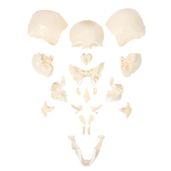 Anatomical Model-A-105179, 22-Part Disarticulated Life-Size Human Skull